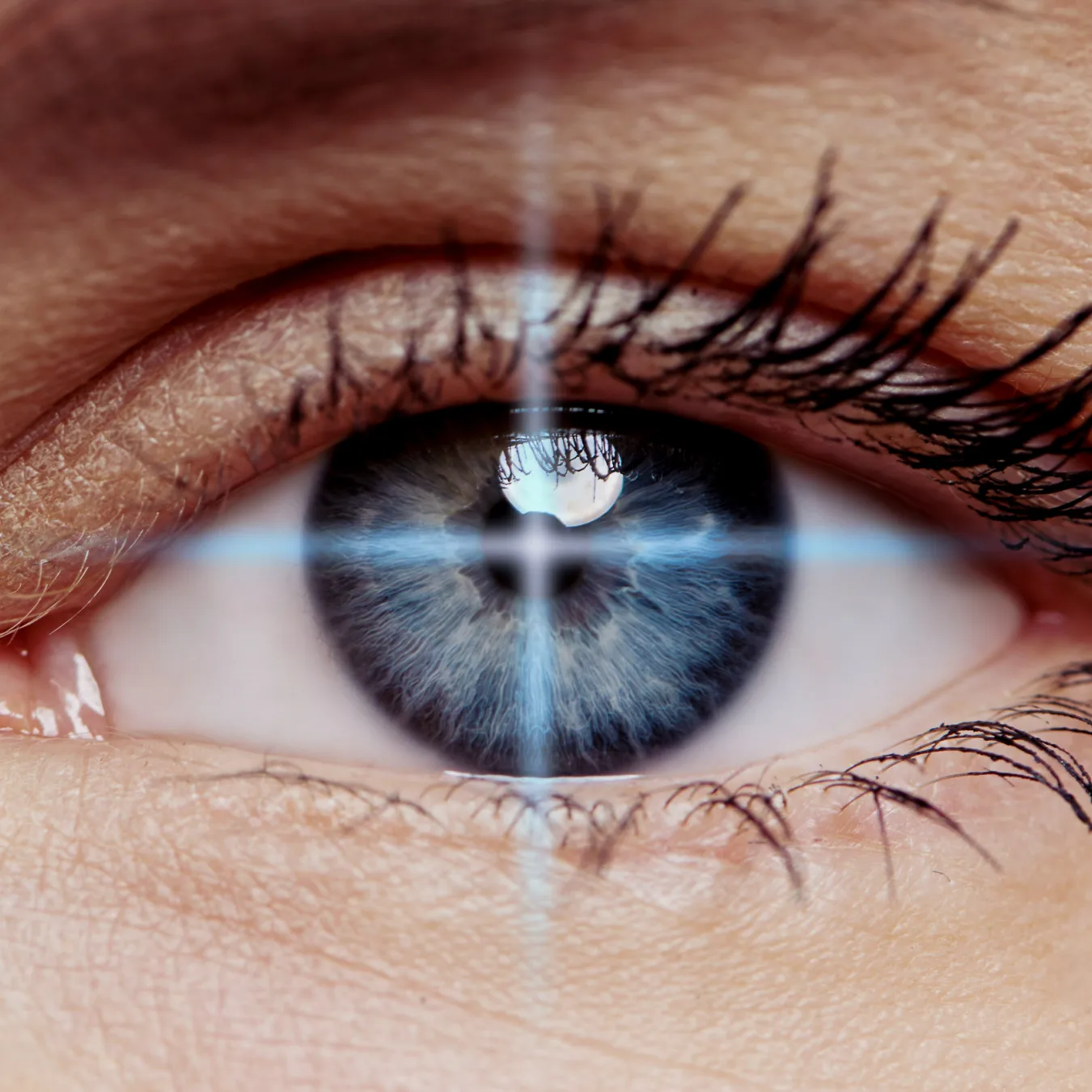 laser eye surgery on an eye close up